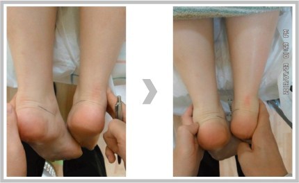 case1-2